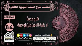 شرح حديث لا رقية الا من عين او حمة